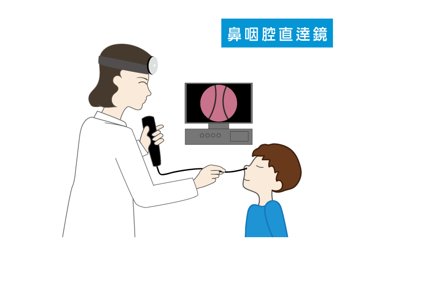 鼻咽腔直逹鏡検査