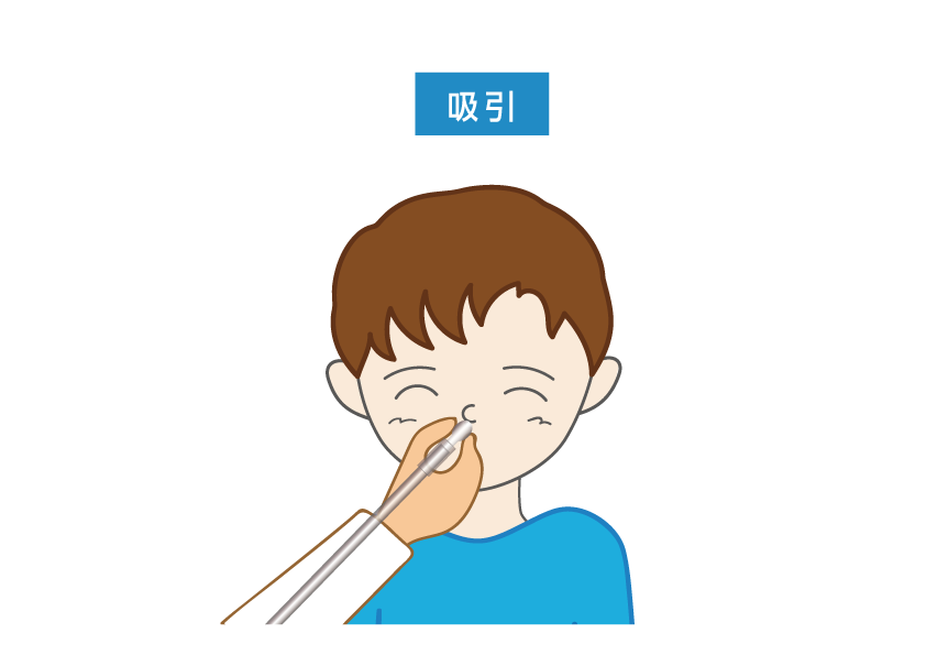 吸引