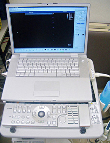 超音波検査機器