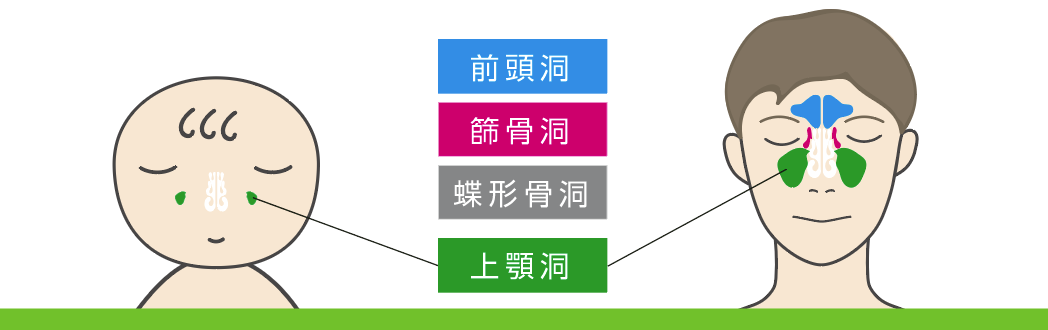 小児の副鼻腔炎