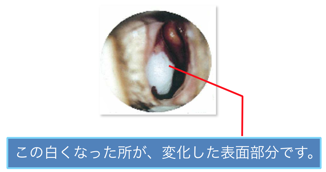 トリクロロ塗布後